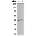 LifeSab™ Annexin A1 (pY21) Rabbit pAb (50 µl)