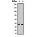 LifeSab™ MCT14 Rabbit pAb (50 µl)