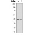 LifeSab™ CD296 Rabbit pAb (50 µl)