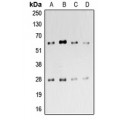 LifeSab™ CD69 Rabbit pAb (50 µl)