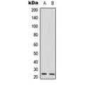 LifeSab™ IL-22 Rabbit pAb (50 µl)