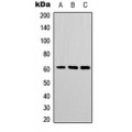 LifeSab™ POTEH Rabbit pAb (50 µl)