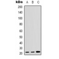 LifeSab™ p21 Rabbit pAb (50 µl)