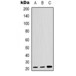 LifeSab™ p21 Rabbit pAb (50 µl)