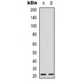 LifeSab™ RhoG Rabbit pAb (50 µl)