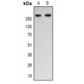 LifeSab™ p300 (AcK1542) Rabbit pAb (50 µl)