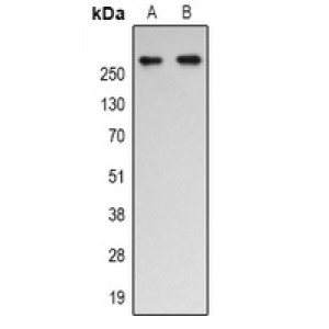 LifeSab™ p300 (AcK1542) Rabbit pAb (50 µl)