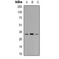 LifeSab™ GGH Rabbit pAb (50 µl)