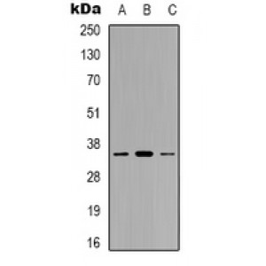 LifeSab™ GGH Rabbit pAb (50 µl)