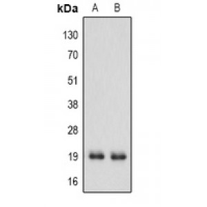 LifeSab™ IFN alpha 1 Rabbit pAb (50 µl)