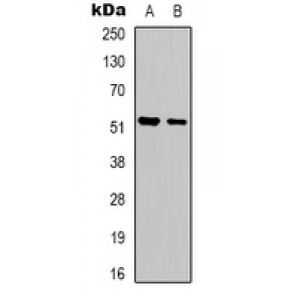 LifeSab™ Serpin A1 Rabbit pAb (50 µl)