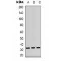 LifeSab™ CD74 Rabbit pAb (50 µl)