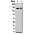 LifeSab™ RFC1 Rabbit pAb (50 µl)