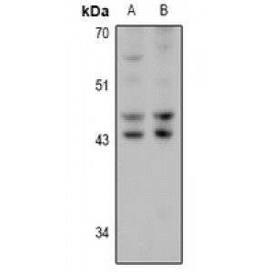 LifeSab™ HSD17B2 Rabbit pAb (50 µl)