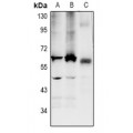 LifeSab™ LPCAT2 Rabbit pAb (50 µl)