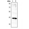 LifeSab™ Annexin A10 Rabbit pAb (50 µl)