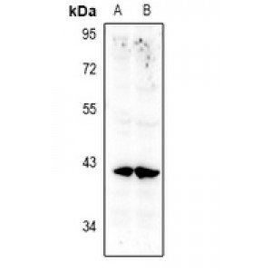 LifeSab™ Annexin A10 Rabbit pAb (50 µl)