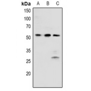 LifeSab™ BRK (pY342) Rabbit pAb (50 µl)