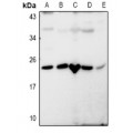 LifeSab™ RASL10B Rabbit pAb (50 µl)