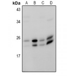 LifeSab™ RAB18 Rabbit pAb (50 µl)