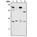 LifeSab™ RAB1B Rabbit pAb (50 µl)