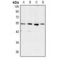 LifeSab™ SHD Rabbit pAb (50 µl)