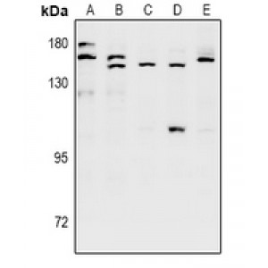 LifeSab™ SH3TC1 Rabbit pAb (50 µl)