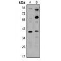 LifeSab™ ZNT8 Rabbit pAb (50 µl)