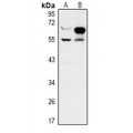 LifeSab™ ZNF446 Rabbit pAb (50 µl)