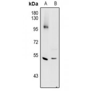 LifeSab™ Cathepsin C HC Rabbit pAb (50 µl)