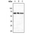 LifeSab™ Estrogen Receptor alpha Rabbit pAb (50 µl)