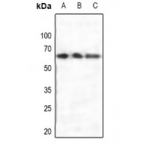 LifeSab™ Estrogen Receptor alpha Rabbit pAb (50 µl)