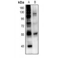 LifeSab™ ETS1 Rabbit pAb (50 µl)