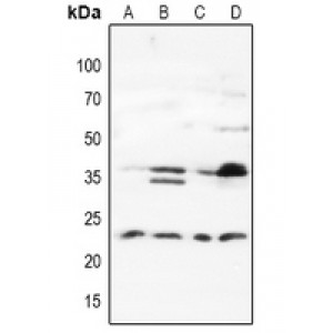 LifeSab™ MAD2L1BP Rabbit pAb (50 µl)