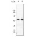 LifeSab™ ROR gamma Rabbit pAb (50 µl)