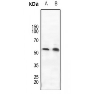 LifeSab™ ROR gamma Rabbit pAb (50 µl)