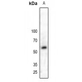 LifeSab™ MPP6 Rabbit pAb (50 µl)