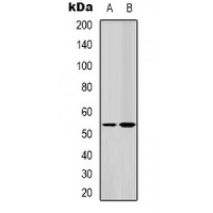 LifeSab™ LKB1 Rabbit pAb (50 µl)