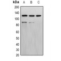 LifeSab™ Progesterone Receptor Rabbit pAb (50 µl)