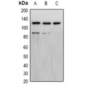 LifeSab™ Progesterone Receptor Rabbit pAb (50 µl)