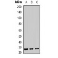 LifeSab™ Carbonic Anhydrase 12 Rabbit pAb (50 µl)