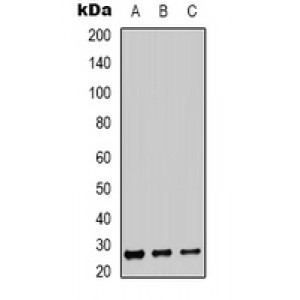 LifeSab™ Carbonic Anhydrase 12 Rabbit pAb (50 µl)