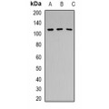 LifeSab™ ZDHHC20 Rabbit pAb (50 µl)