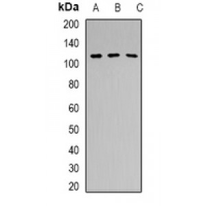 LifeSab™ ZDHHC20 Rabbit pAb (50 µl)