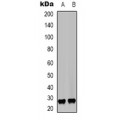 LifeSab™ RagC Rabbit pAb (50 µl)