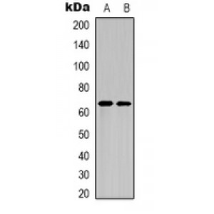 LifeSab™ NF-kappaB p65 (AcK218) Rabbit pAb (50 µl)