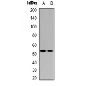 LifeSab™ p53 Rabbit pAb (50 µl)