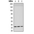 LifeSab™ STRA8 Rabbit pAb (50 µl)