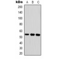 LifeSab™ Transferrin Rabbit pAb (50 µl)