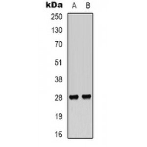 LifeSab™ CKLF1 Rabbit pAb (50 µl)